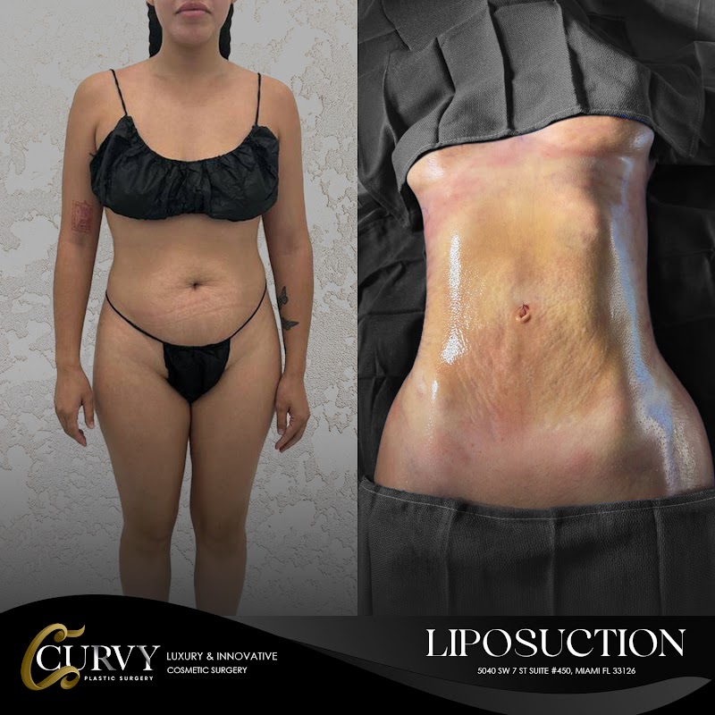 Curvy Plastic Surgery logo