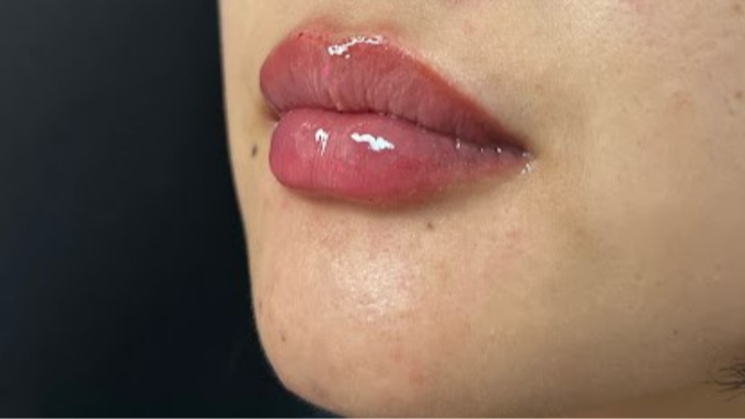 Zen Luxe Medspa & IV Lounge logo